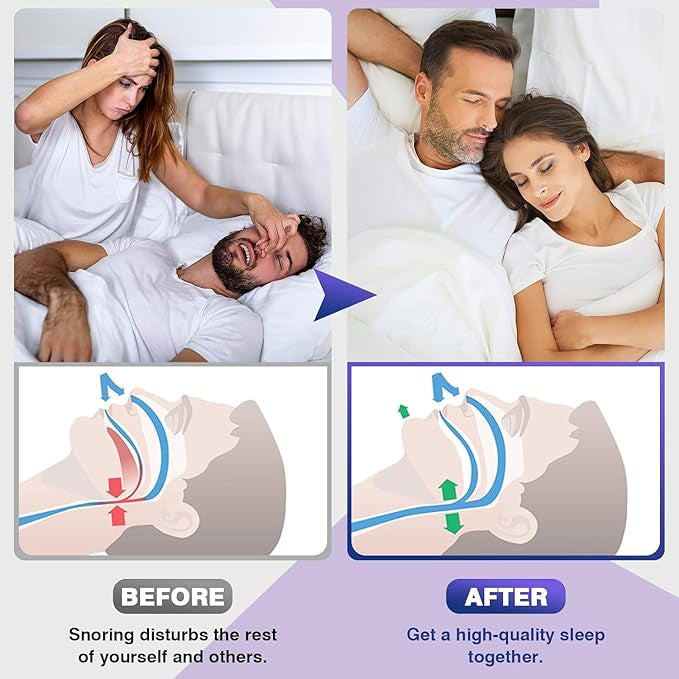 Anti Snoring Device